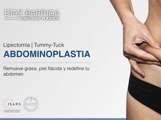 Dr. Julio Cesar Díaz Barriga - Abdominoplastia