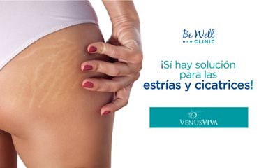 Venus Viva | Eliminación de estrías y cicatrices ! Venus Concept