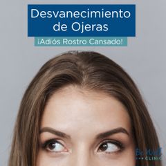 Reducción de Ojeras
