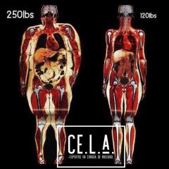 Ce.LA