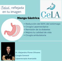 CeLA