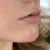 Aumento de labios, genial, me lo volvería a hacer.