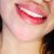 Labios perfectos con ácido hialuronico
