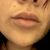 Aumento de labios, aun no se si lo volveria a hacer