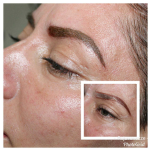 antes y después micropigmentación 